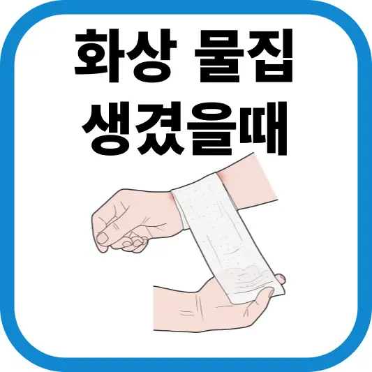 화상 물집 생겼을때, 화상 물집 터짐 어떻게 해야 할까요?