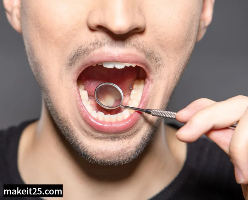 의학용어 MRSA, Pleural Effusion, Calf, Agitation, Drainage 정리